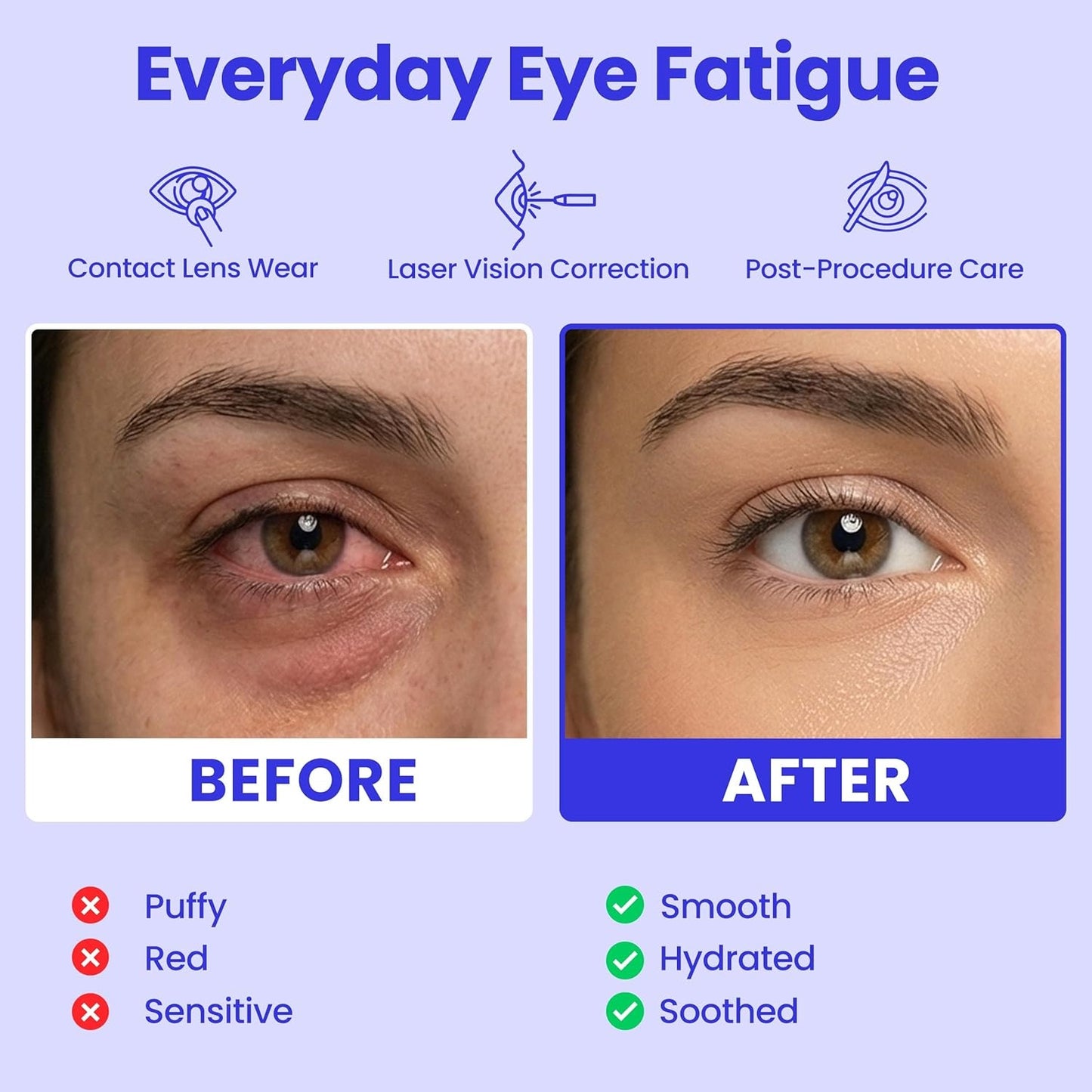 Steam Eye Mask
